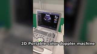Mesin doppler warna portabel US15 Plus 2D