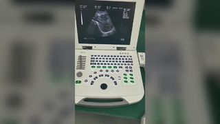 Sistem Diagnostik Ultrasound laptop digital penuh 80elemen BR-US11
