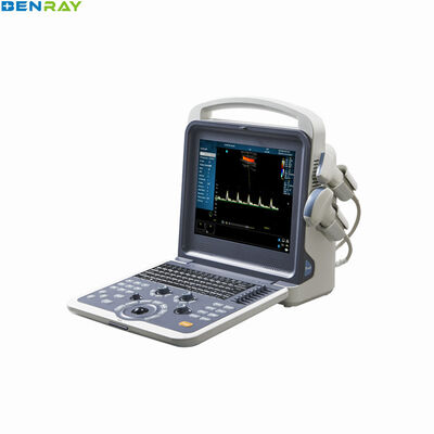 Sistem Diagnostik ultrasonik doppler Warna Portabel 80 elemen