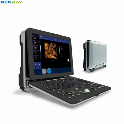 Perangkat USG Medis Mesin Doppler Warna 4D Portable